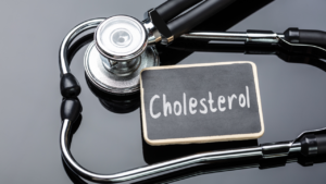 Silent signs of high cholesterol to watch for