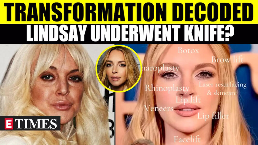 lindsay-lohan’s-looks-under-the-microscope:-$300k-surgery-revealed?